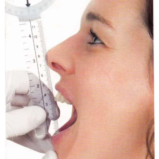 Kaakfysiotherapie (Orofaciaal)
